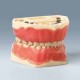 Modelo Dentário Pediátrico AK-6/2