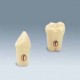 Dentes de Substituição